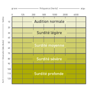 Niveaux surdite